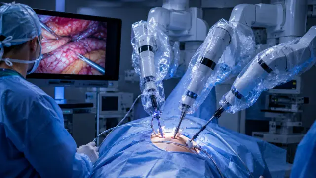 Radical Cystectomy illustration